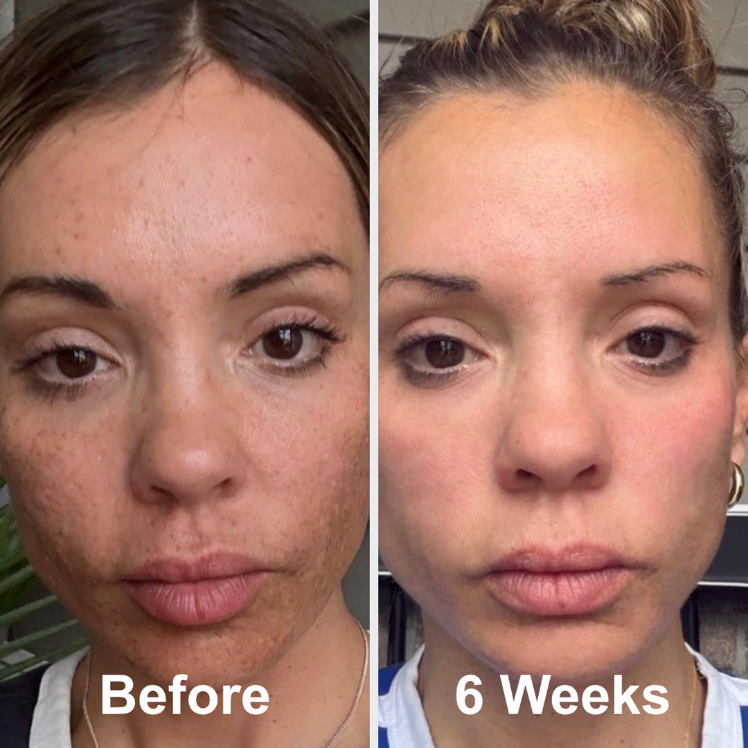 Prep - Gentle Melasma Cleanser