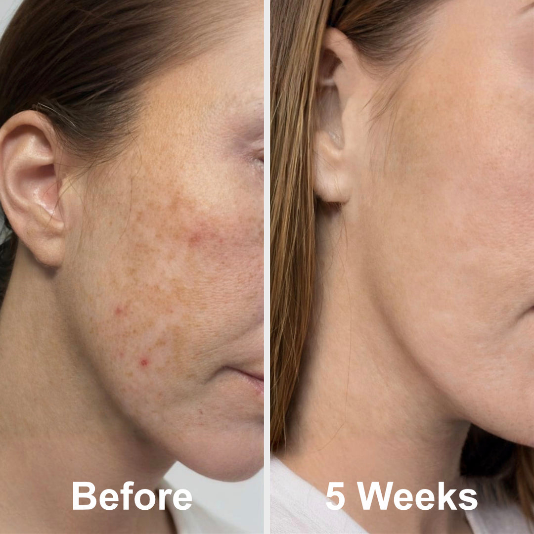 Prep - Gentle Melasma Cleanser