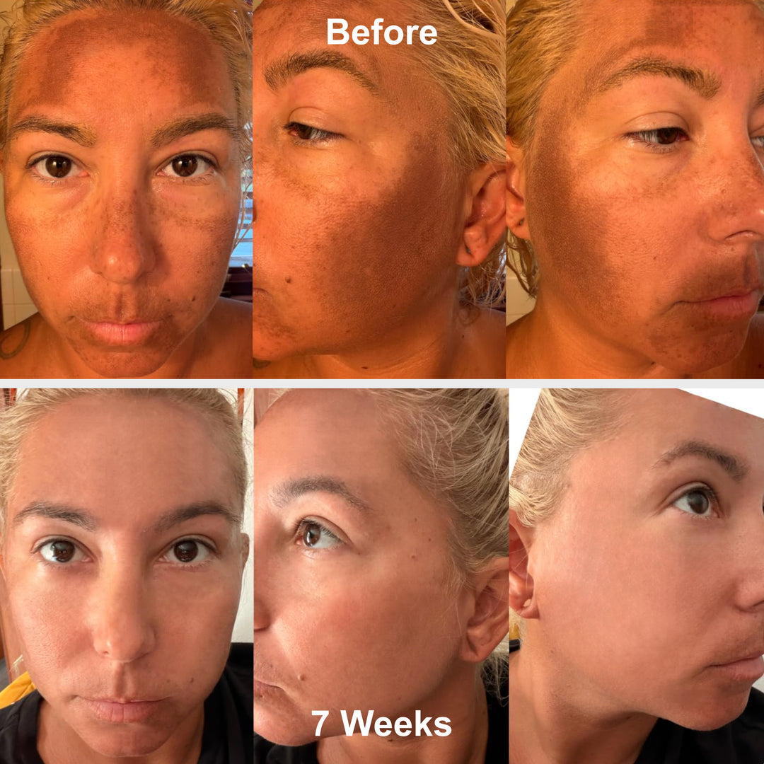 Prep - Gentle Melasma Cleanser