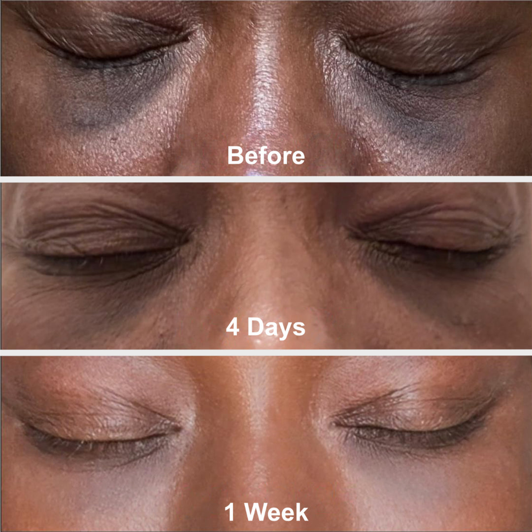 Prep - Gentle Melasma Cleanser