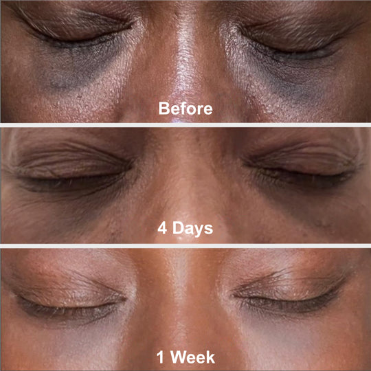 Prep - Gentle Melasma Cleanser