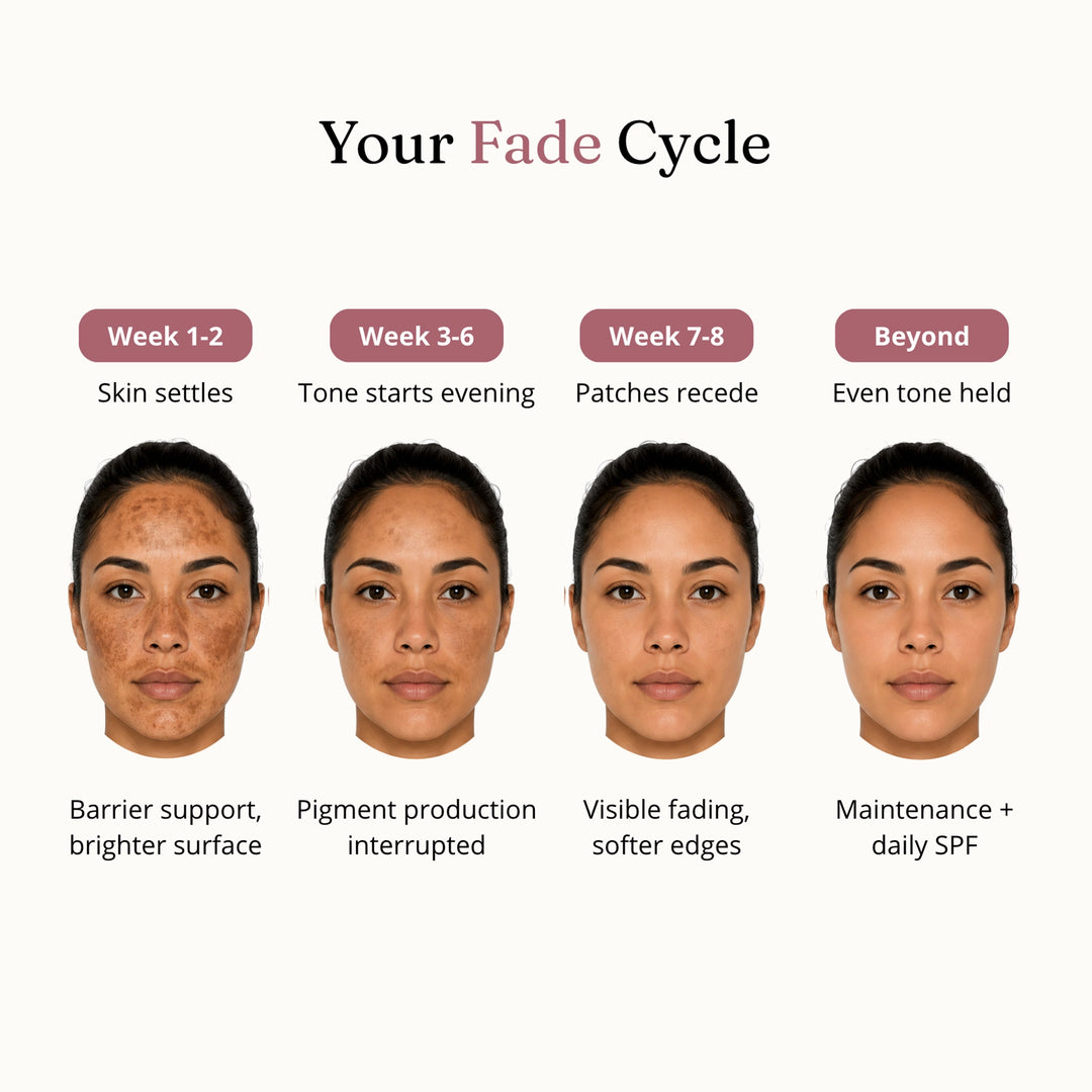Melasma Recovery Cream